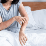 What Should You Do If You Stayed At A Hotel With Bed Bugs?