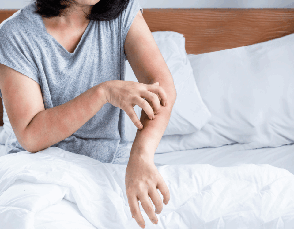 What Should You Do If You Stayed At A Hotel With Bed Bugs?