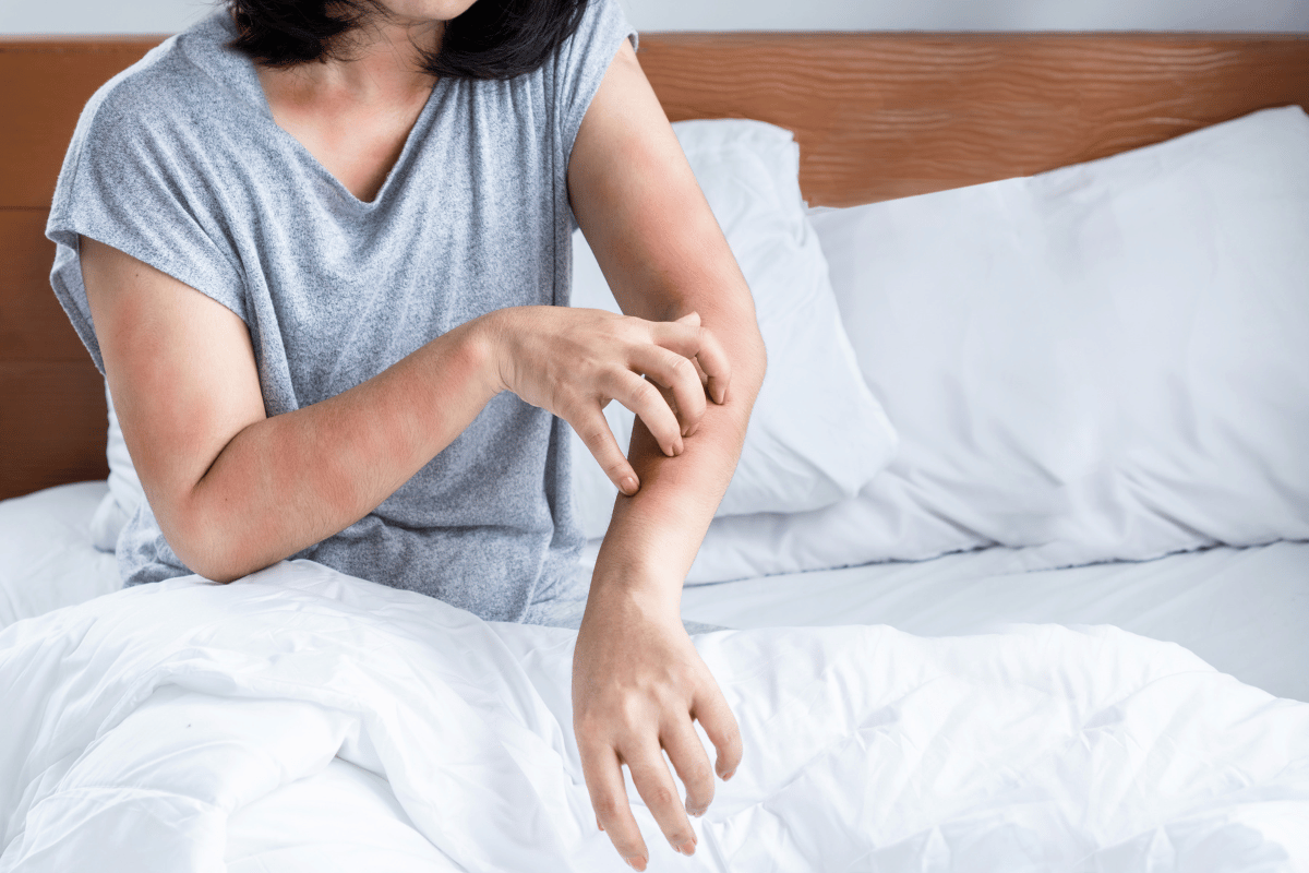 What Should You Do If You Stayed At A Hotel With Bed Bugs?