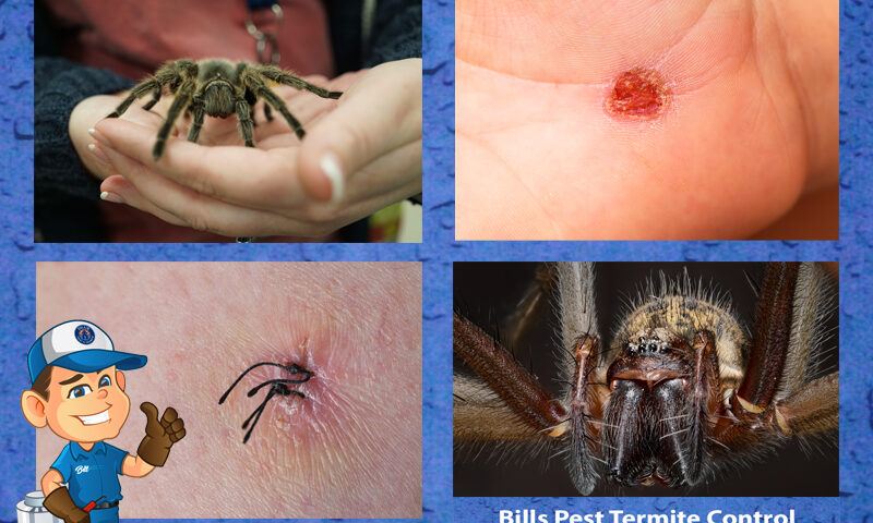 How to Treat Spider Bites