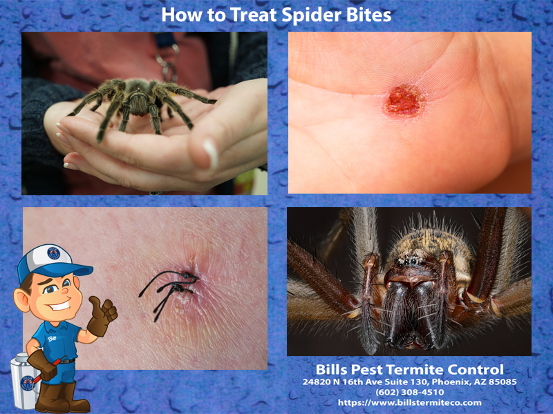 How to Treat Spider Bites